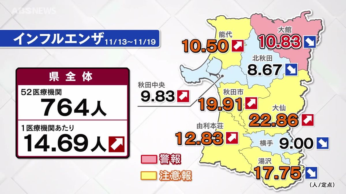 インフルエンザ患者数　増加に転じる　警報注意報も