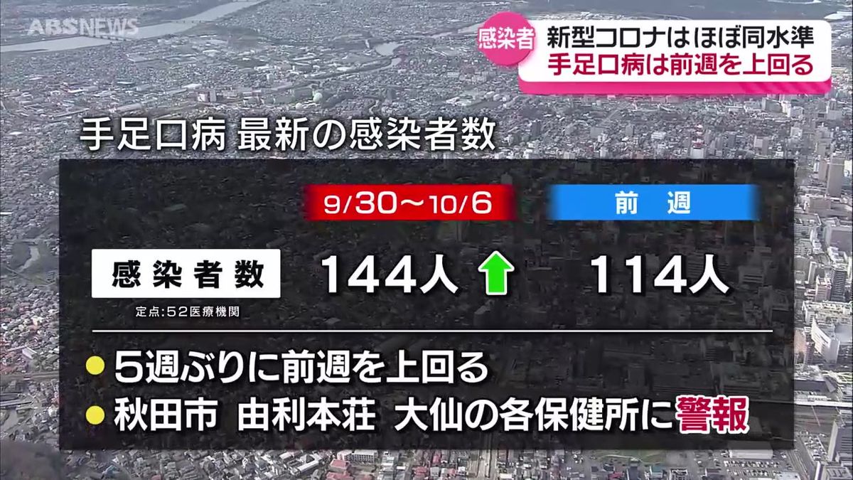 新型コロナの感染者数はほぼ横ばい　夏から流行続く手足口病は5週ぶりに増加　警報も