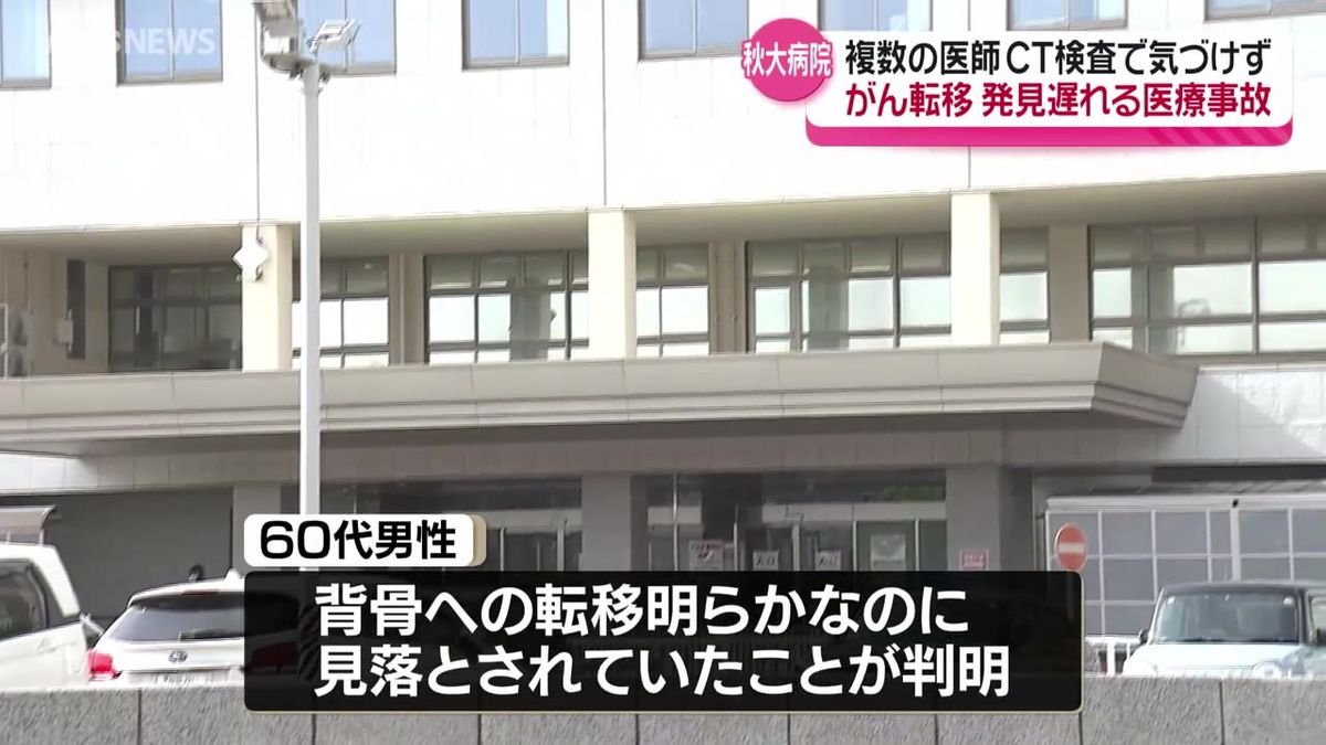 秋田大学医学部附属病院で医療事故　術後のがん転移の発見が遅れる
