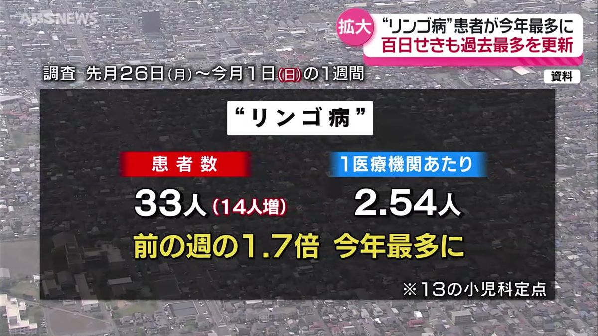伝染性紅斑“リンゴ病”と百日せきに注意　秋田県内でも感染拡大続く