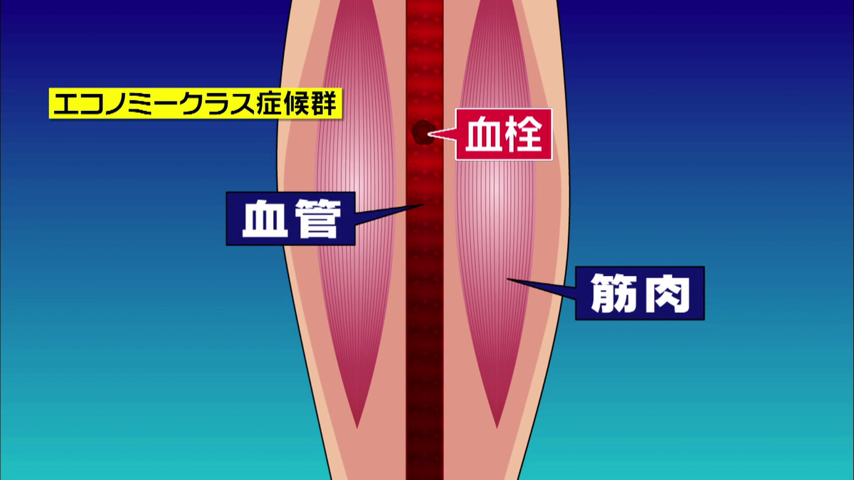 足の血行が悪くなると血栓ができる