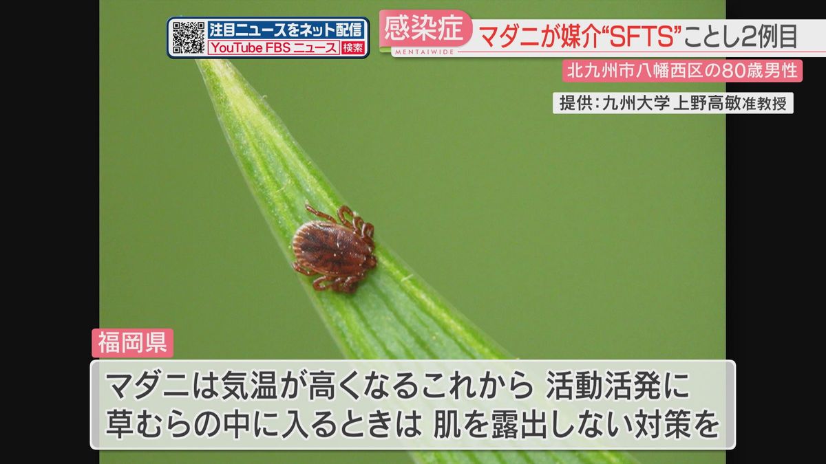 マダニが媒介する感染症　県内でことし2例目