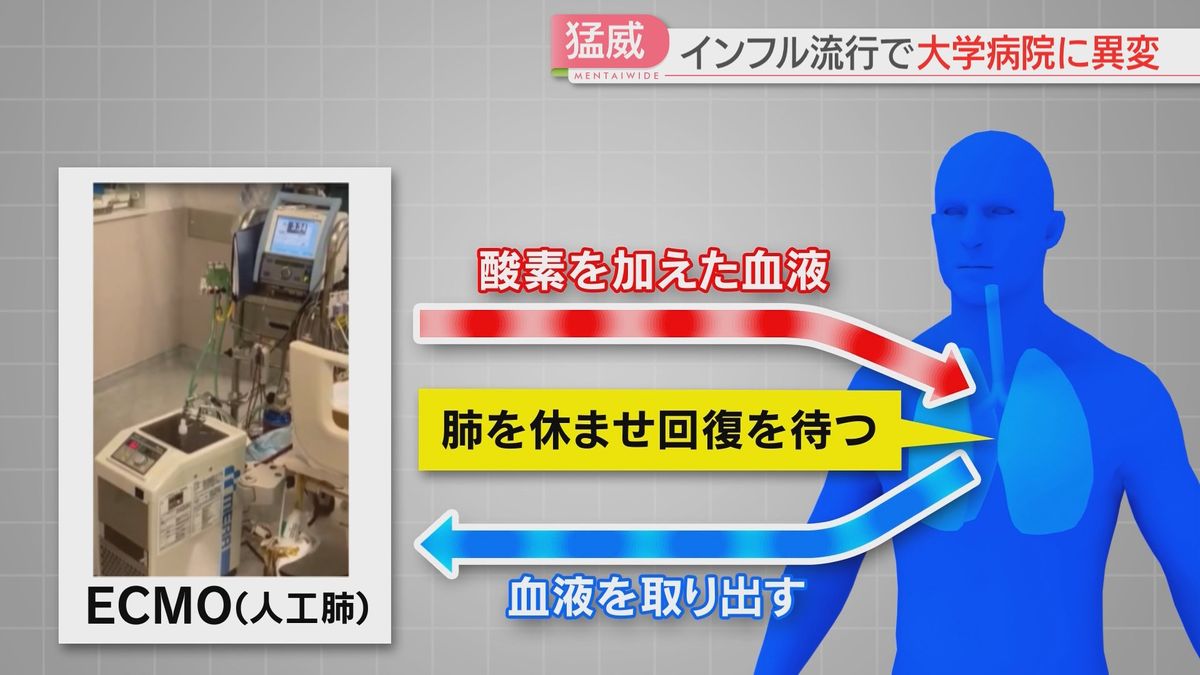 ECMOの仕組み