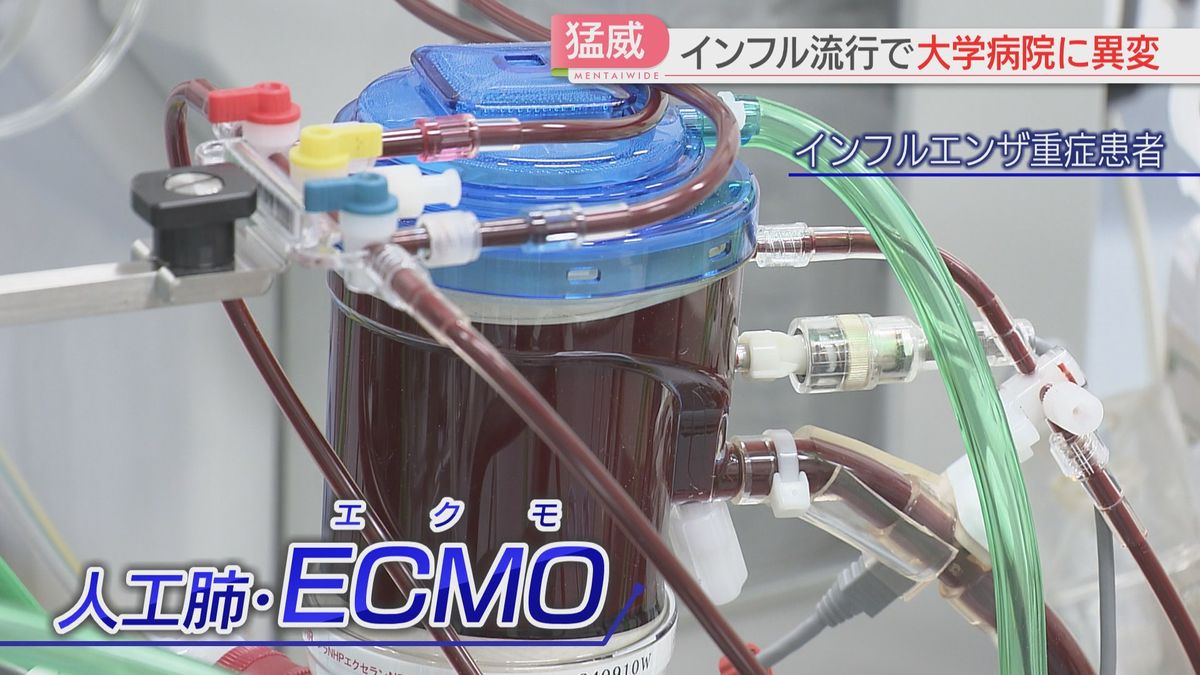 インフルの重症患者にECMOが使われている