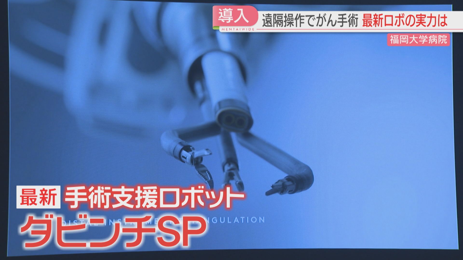 最新の手術支援ロボ「ダビンチSP」従来型は腹部に穴4か所→1か所に