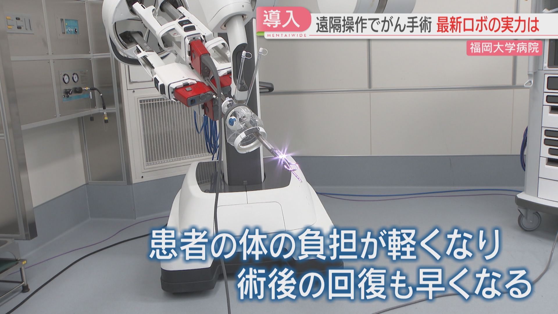 手到病自除 最新の手術支援ロボ「ダビンチSP」従来型は腹部に穴4か所→1か所に