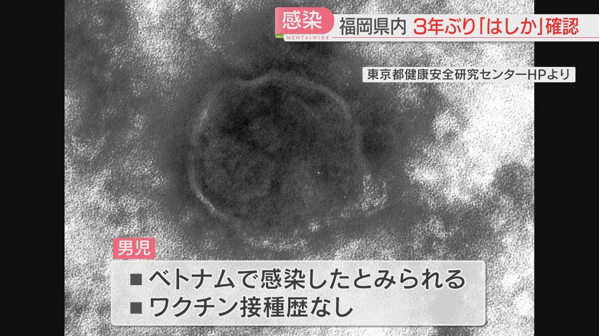 県内で3年ぶり「はしか」確認　男の子はワクチンの接種歴なく　ベトナムで感染したか　福岡