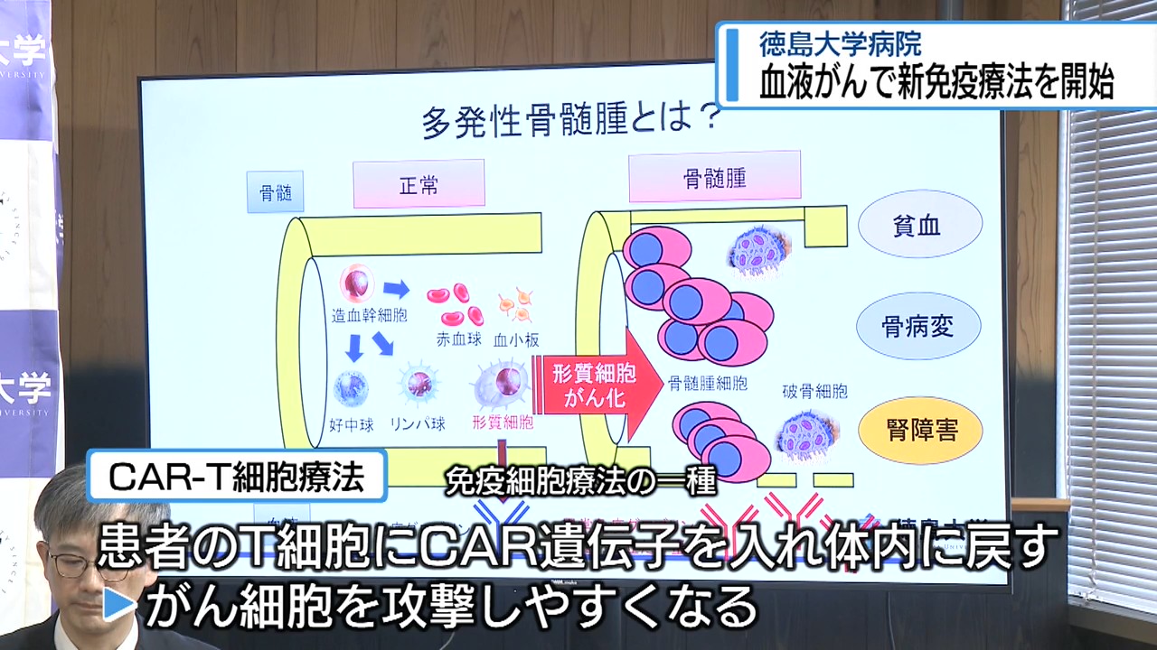 血液がんの「新しい免疫療法」開始 徳島大学【徳島】（2026年6月23日