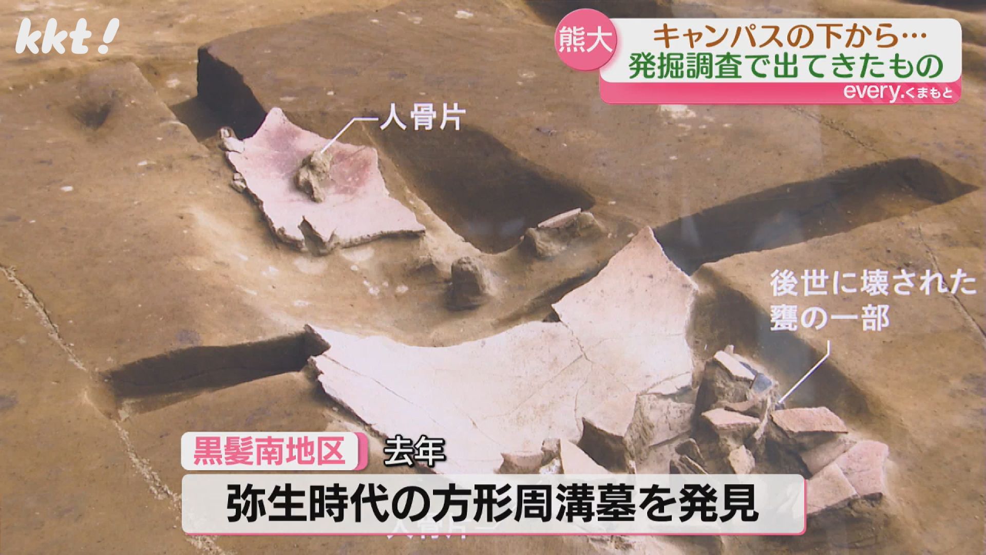 掘ったら色々出てきた｣縄文から明治まで 熊本大学キャンパスで出土した