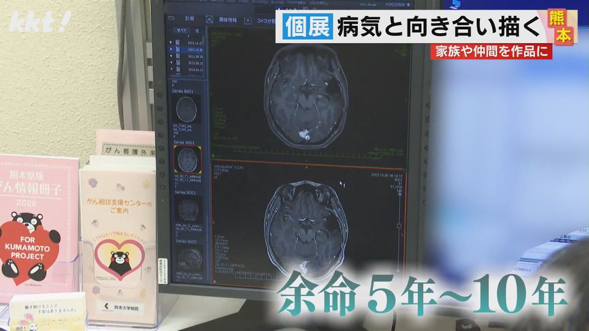 悪性の脳腫瘍で余命5年～10年と宣告