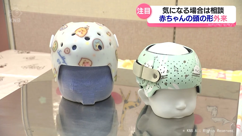 気になる！？赤ちゃんの頭の形外来 県立中央病院にも先月開設（2026年6