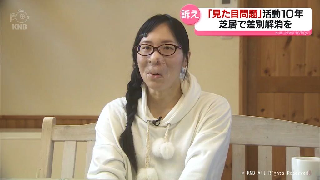 【見た目問題】芝居通して差別解消訴え　10年にわたる活動　