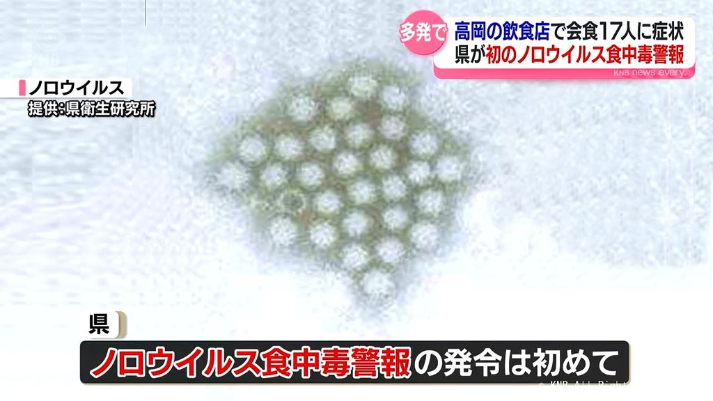 富山県が初の「ノロウイルス食中毒警報」発令　高岡と上市の飲食店で発生相次ぐ　厳重な注意喚起へ