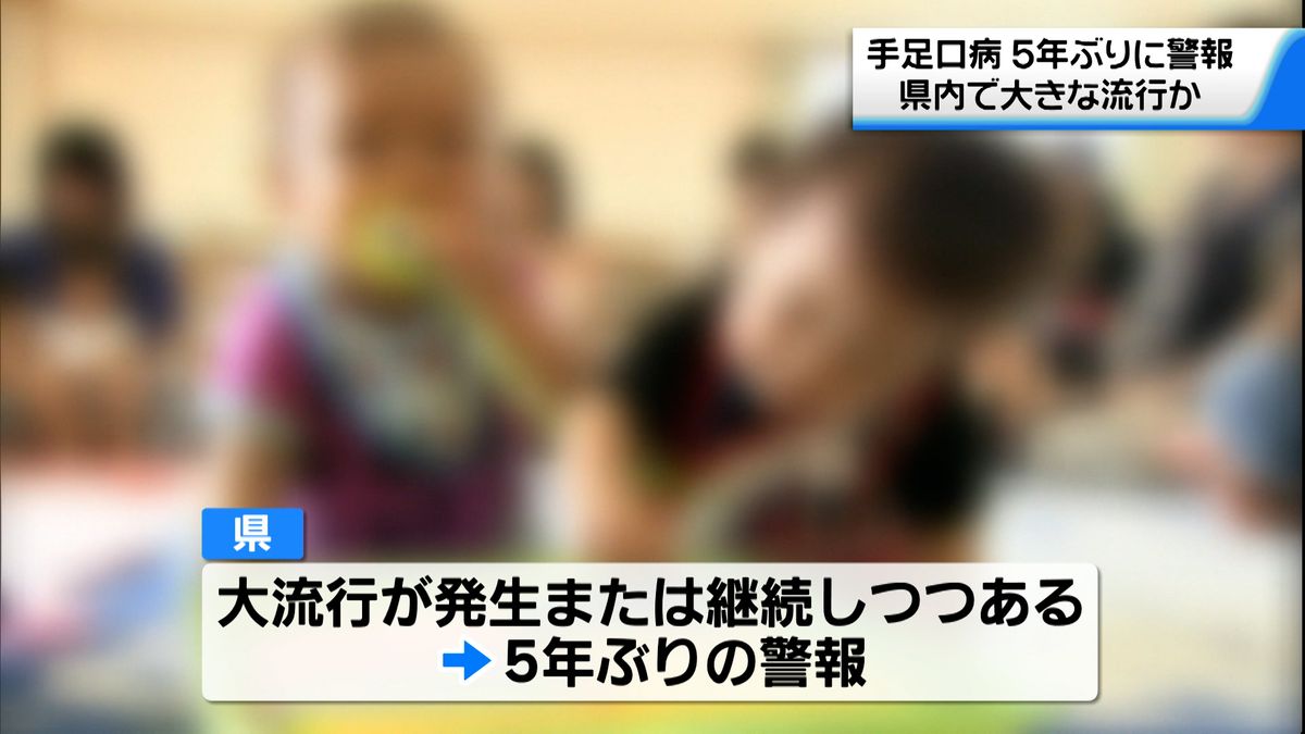 石川県で5年ぶり「手足口病」警報　2週連続で基準超えの患者数確認　