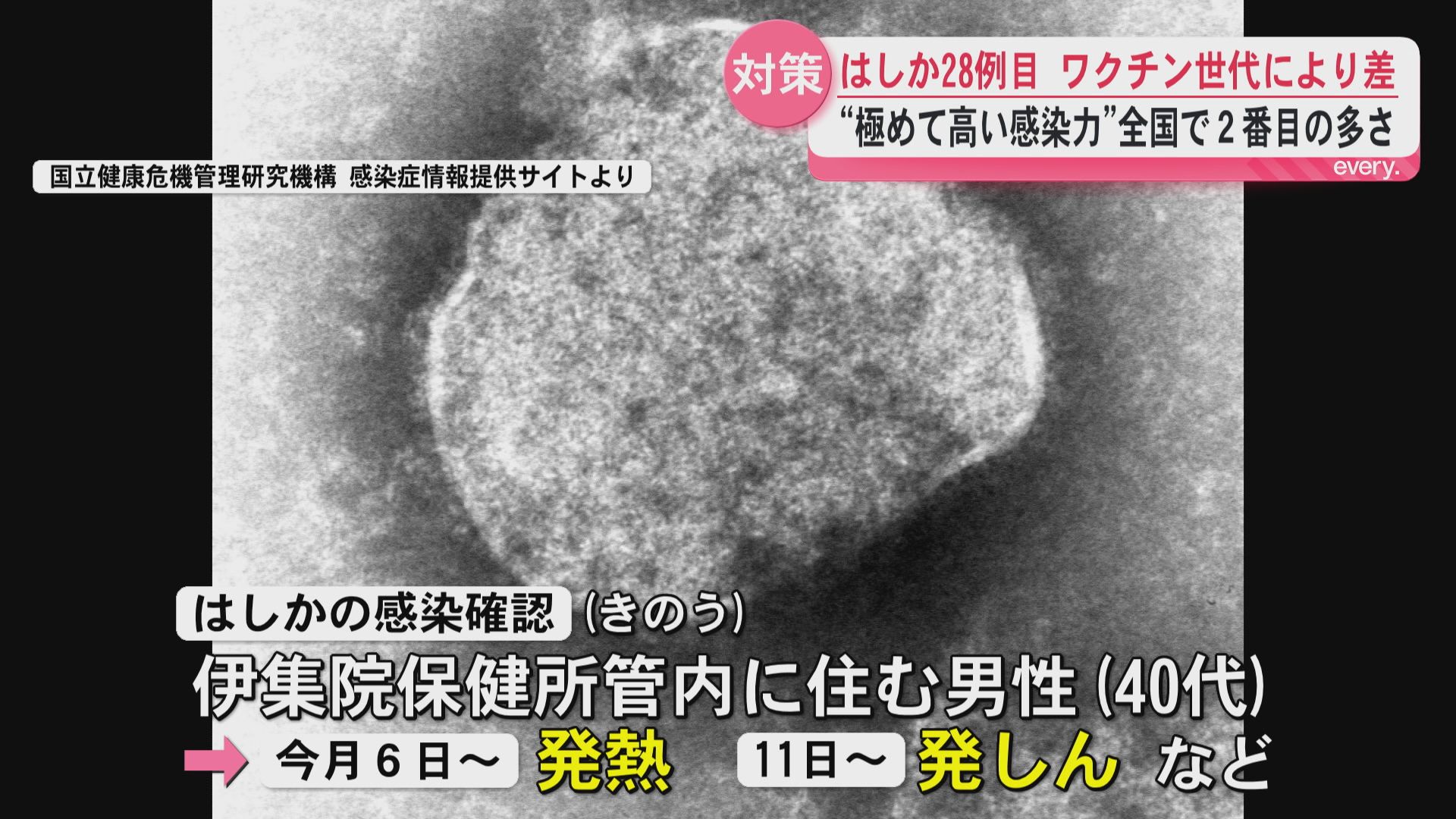 今年28例目の「はしか」感染確認　全国で2番目の多さ…ワクチン接種に世代差も