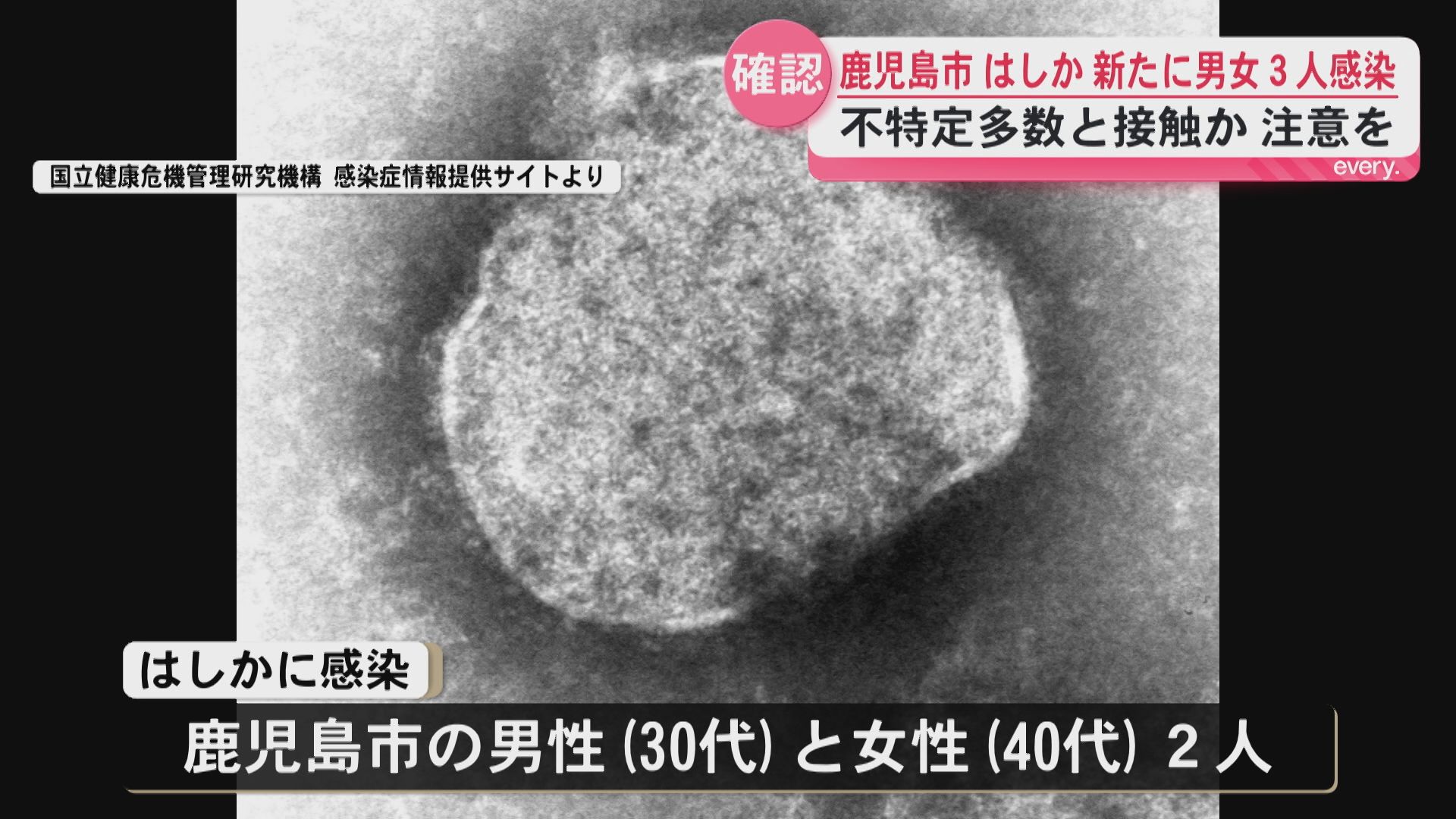 鹿児島市の30代～40代の男女3人が”はしか感染”　県内の今年の感染者は7人に　