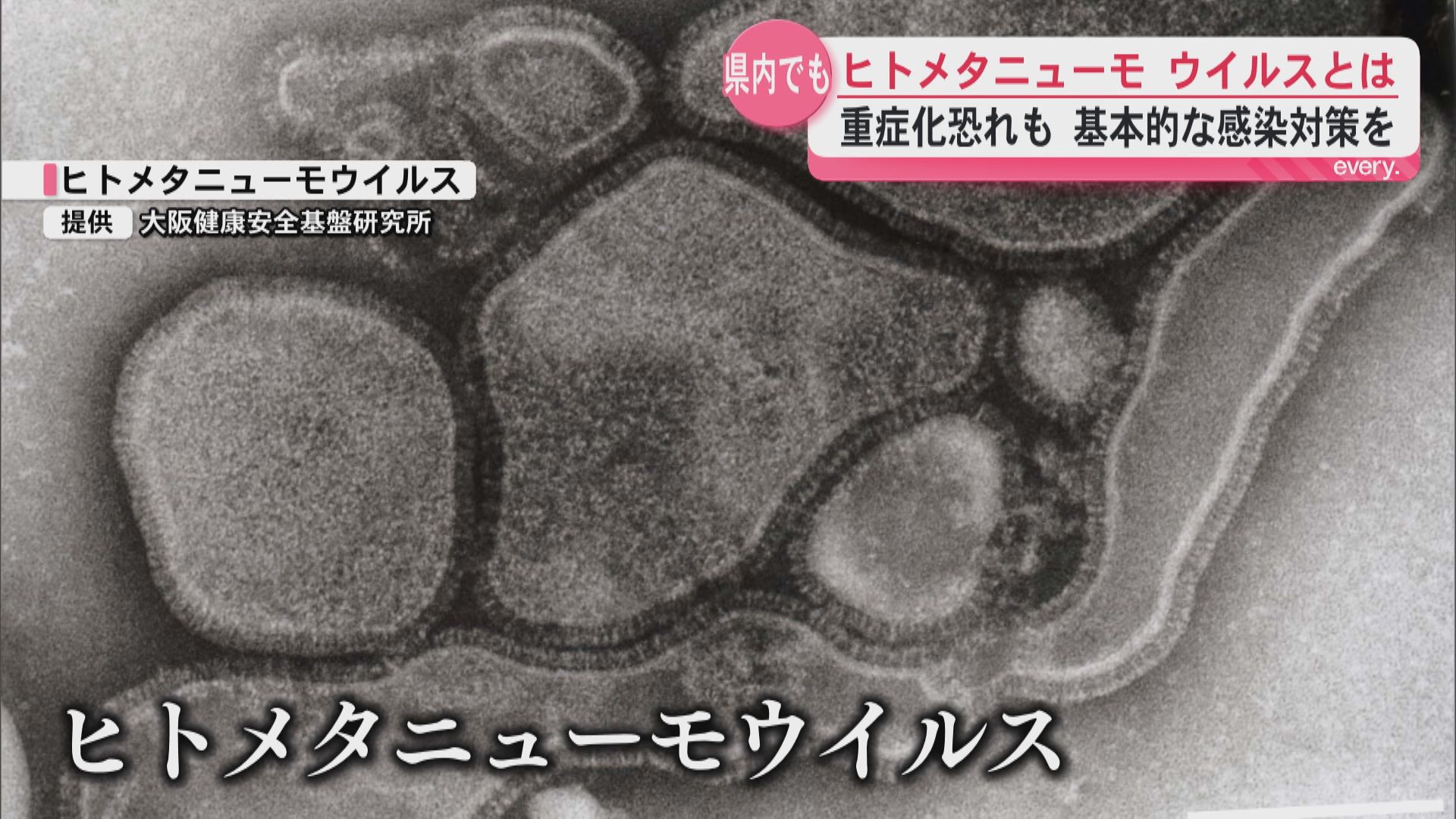 【ヒトメタニューモウイルス】重症化で肺炎なども　鹿児島市内でも園児の感染を確認　手足口病の流行発生警報も継続中