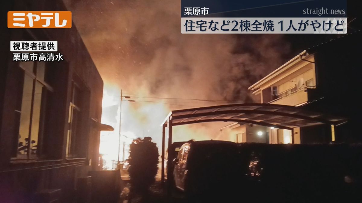 【住宅など2棟全焼】住宅に1人暮らしの男性（79）が軽いやけど（宮城・栗原市）