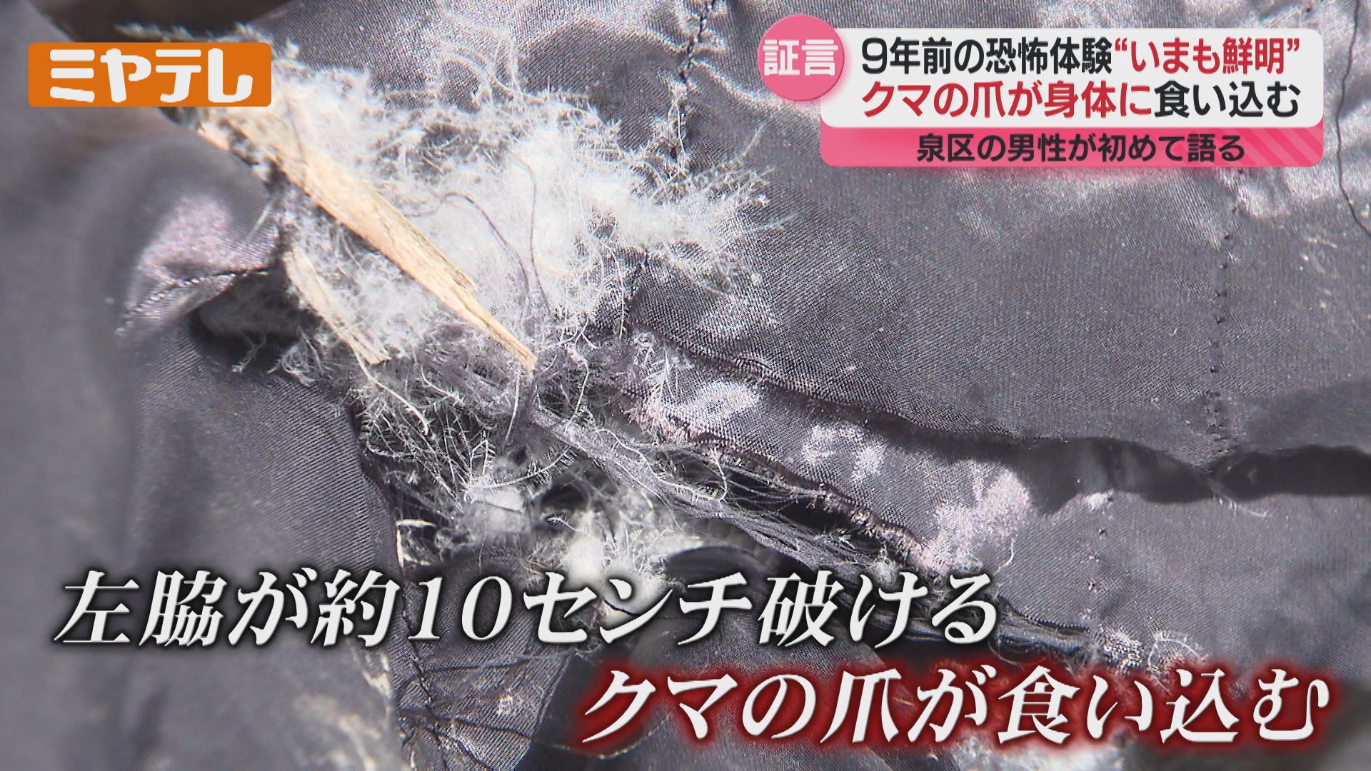カメラに初めて証言】クマに襲われケガした男性、当時の恐怖語る「俺は