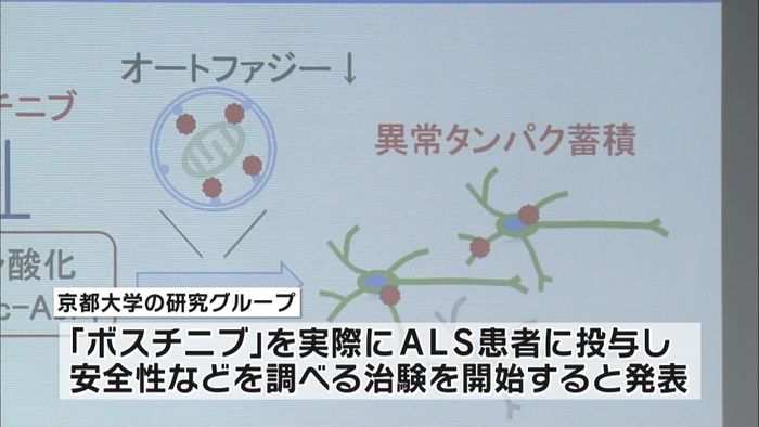 京都大学 ALSに効果ある薬で治験開始へ