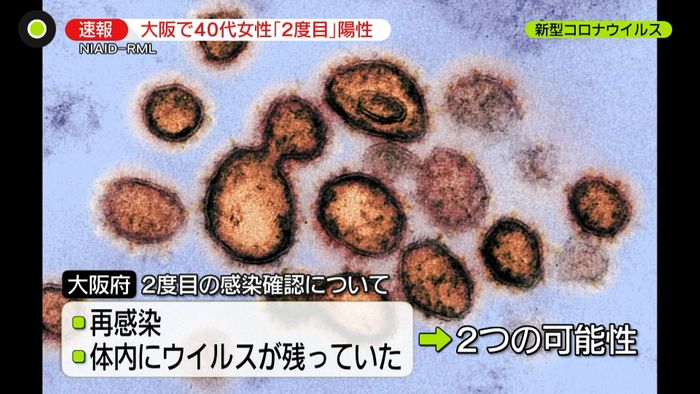 大阪の40代女性 新型コロナ2度目の陽性