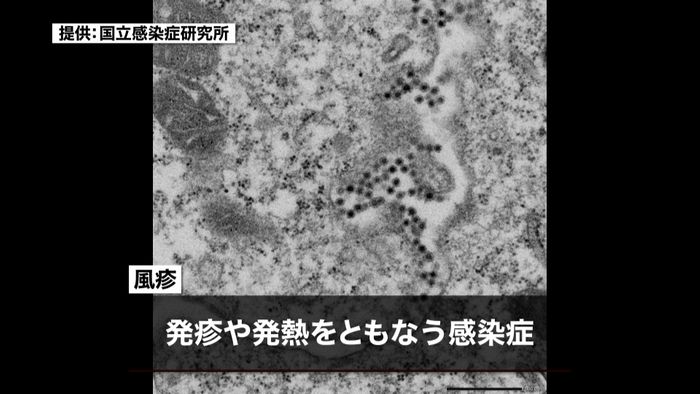 「風疹患者」が大幅増加 感染拡大の恐れ