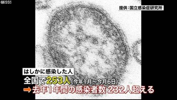 はしか感染250人超、去年1年間を上回る