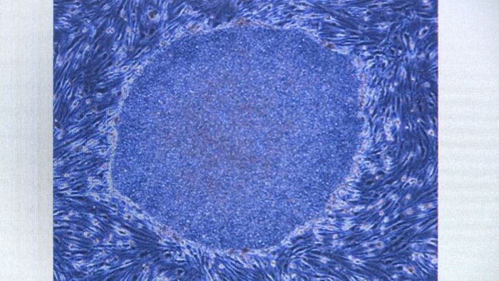 iPS“角膜移植”臨床研究を条件付き了承