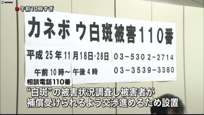 カネボウ“白斑問題”相談電話110番設置