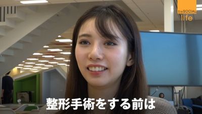 整形に４３０万 公表した２４歳女性の思い