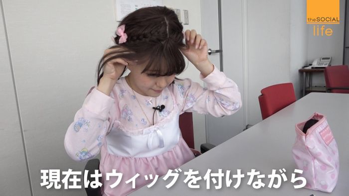 アイドルが「脱毛症」を告白 その理由とは