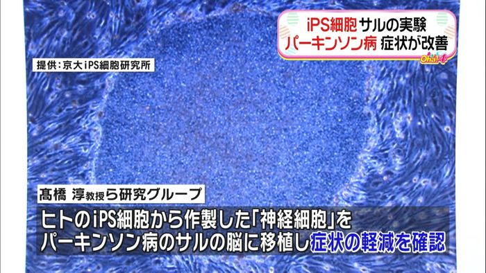 パーキンソン病のサル iPSで症状改善
