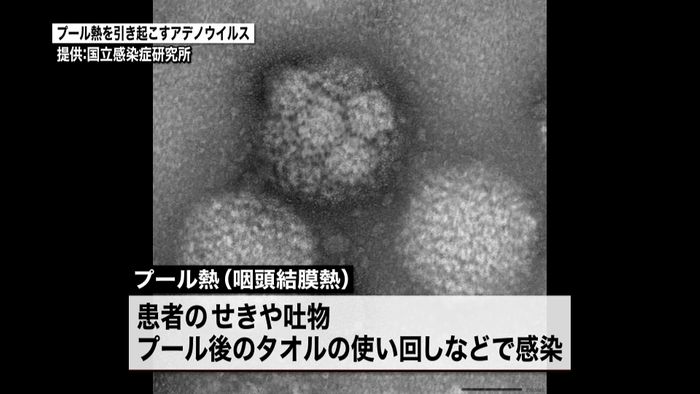 「プール熱」子ども患者、過去10年で最多
