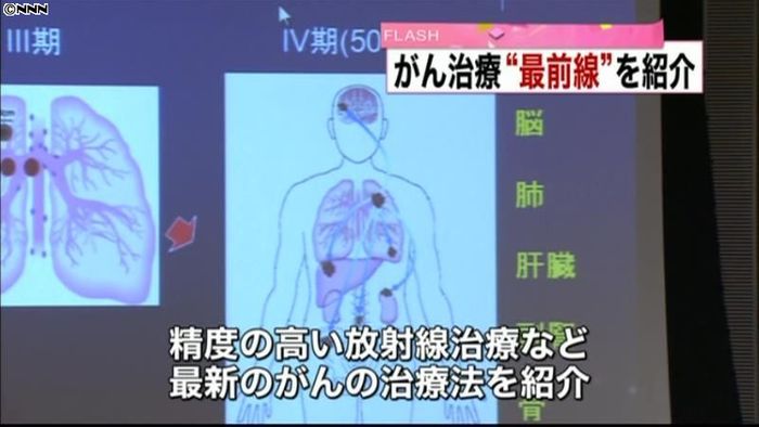 最新のがん治療法を紹介…フォーラム開催