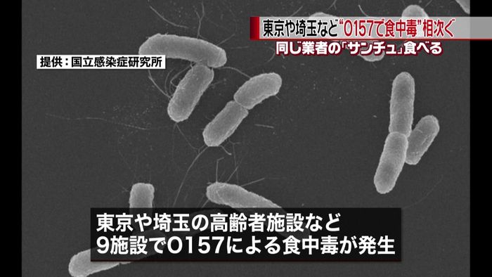 東京、埼玉などでO157 サンチュ食べ?