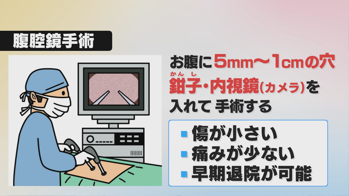 腹腔鏡手術とは