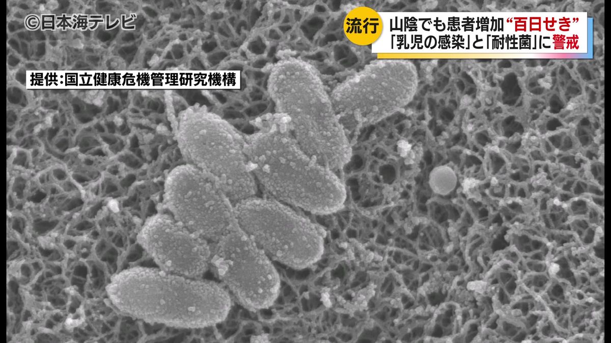 全国的に感染拡大の百日せきに警戒　山陰地方でも急増　乳児が感染すると死につながることも