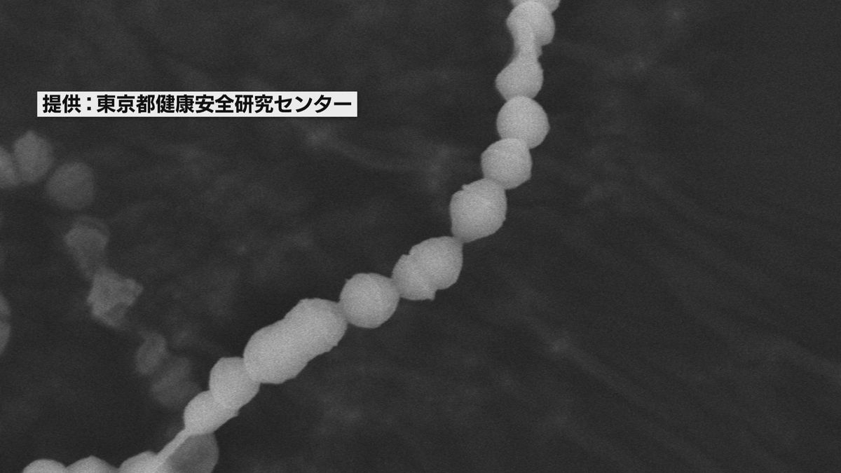 急激なのどの痛みやいちご舌の症状が現れる”溶連菌” 鳥取県で約1年半ぶりに警報解除 引き続き予防を