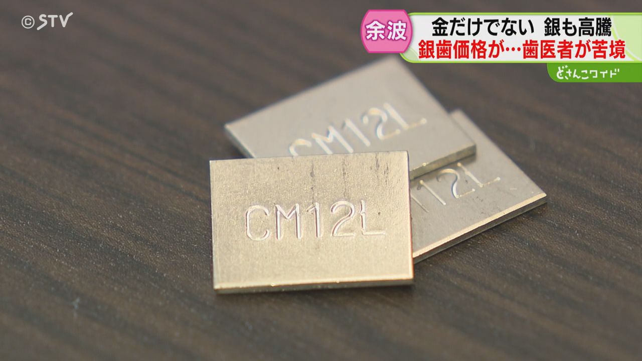 銀価格が3年で4倍に高騰 歯科医院は「赤字になる」銀歯を作れば作る