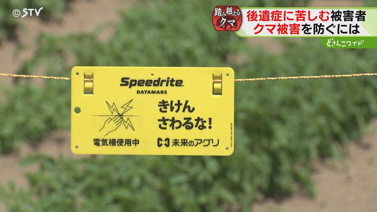 3ページ目 公的補償なく治療費300万円 ヒグマに襲われた男性「100針