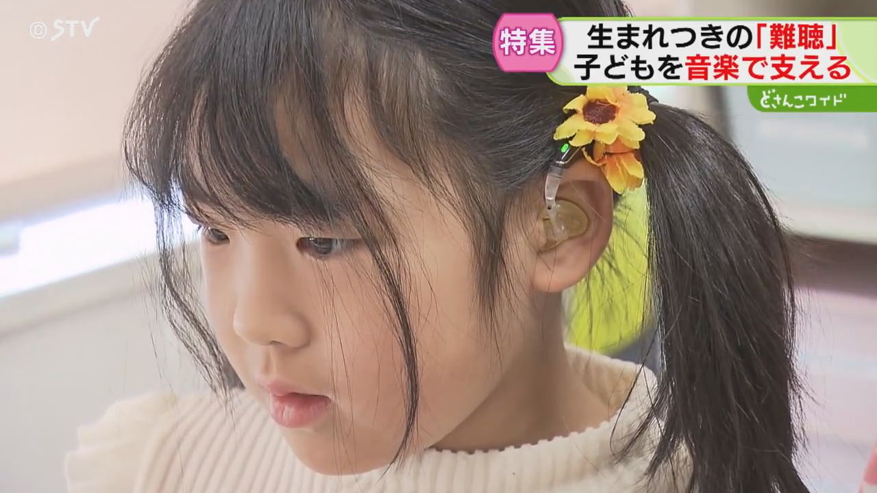 2ページ目 生まれつきの「難聴」6歳女の子…音楽は希望 成長や発達を