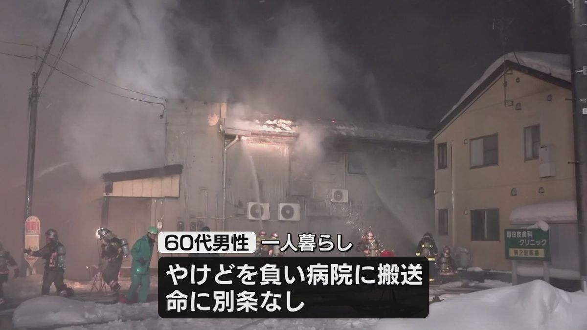 長岡市で住宅全焼が相次ぐ　60代の男性がやけど負い搬送 《新潟》