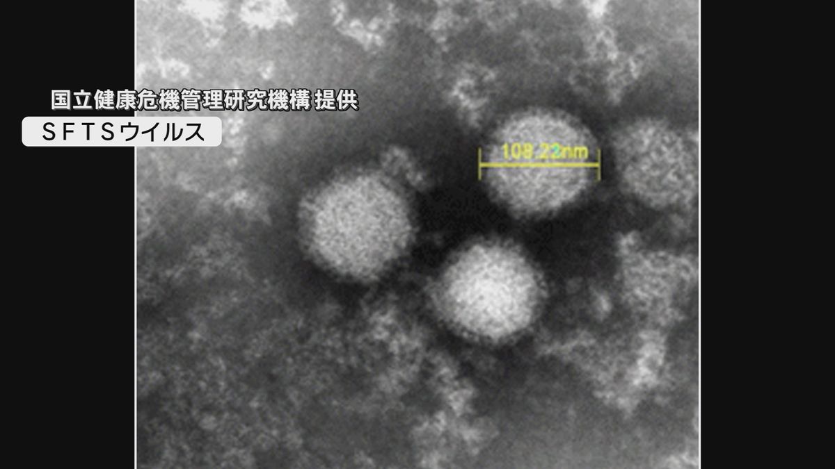 70代男性がマダニにかまれSFTSウイルス感染　意識障害などの症状　県内の感染確認は今年初　大分