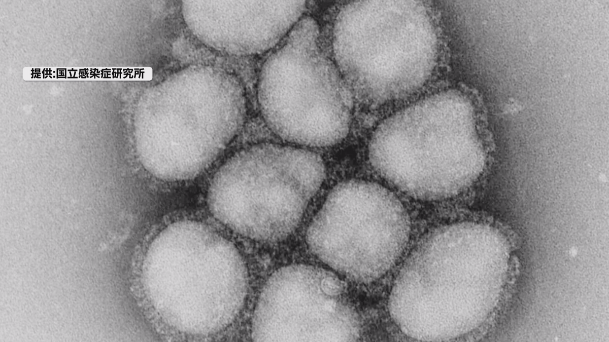 長野県全域にインフルエンザ警報　患者数は1医療機関当たり35.55人　手洗い・こまめな換気など感染予防を　