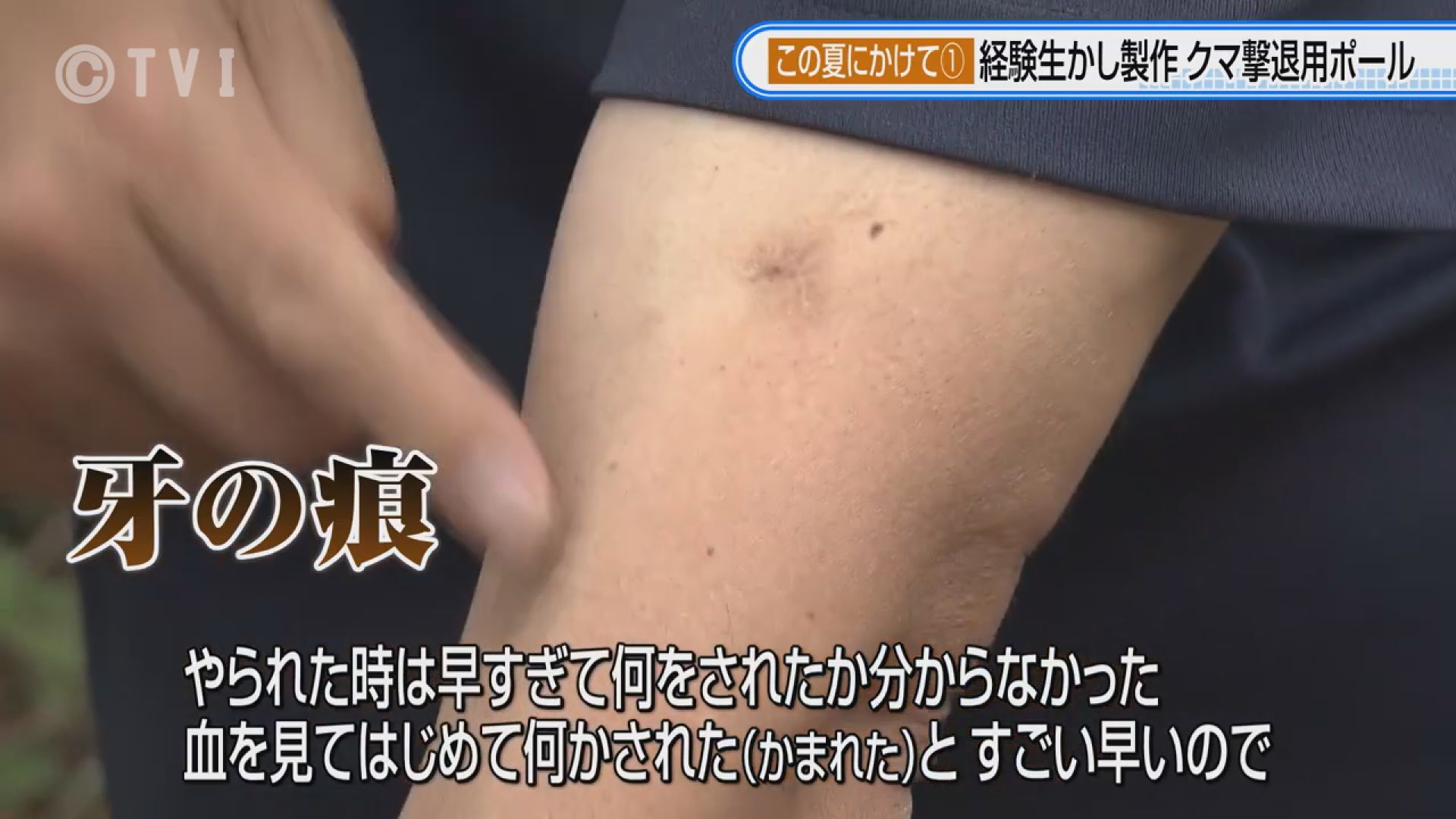 この夏にかけて①クマに襲われた男性「クマ撃退用ポール」開発 自らの