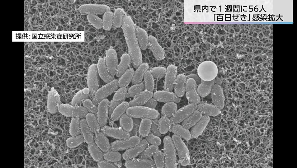「1人かかると10から15人ぐらいかかる可能性」百日ぜき感染拡大で1週間に前年1年間とほぼ同数に 大人が「知らないうちに」感染を広げる可能性も