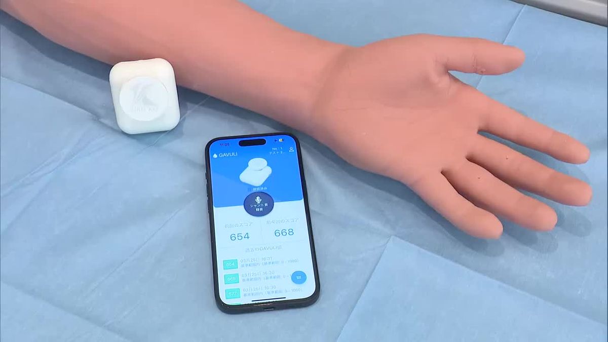 透析患者のシャント音を聴診する電子聴診器と専用管理アプリ　宮崎大学などの研究チームが開発