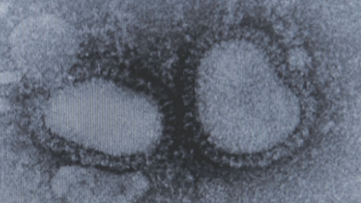 山形県内全域に「インフルエンザ注意報」　過去10年で最も早い発表　患者数10週連続で増加