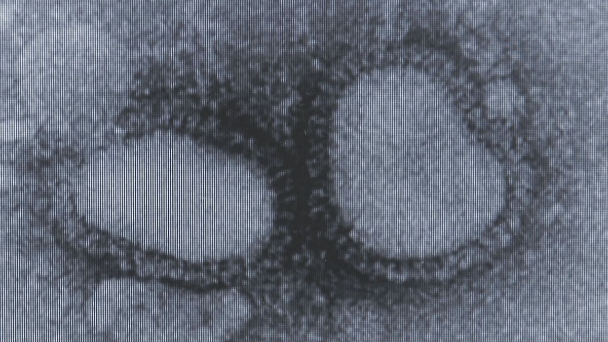 山形県内インフルエンザの流行期に　患者数は前の週の４倍