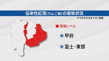 「リンゴ病」流行が警報レベル入り 甲府と富士・東部管内 百日ぜきも高止まり 山梨